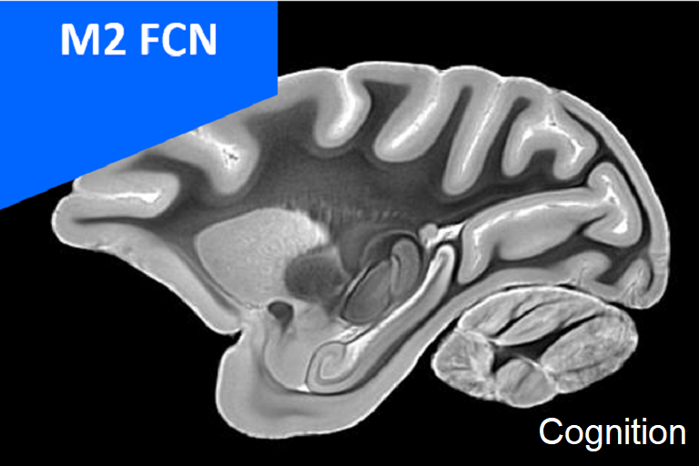 M2 FCN - Neural Basis of Cognition