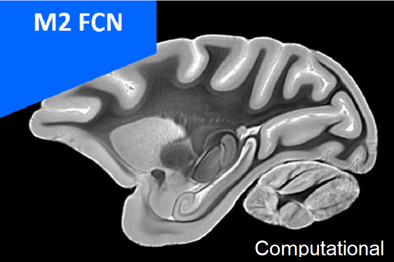 M2 FCN - Computational Neurosciences